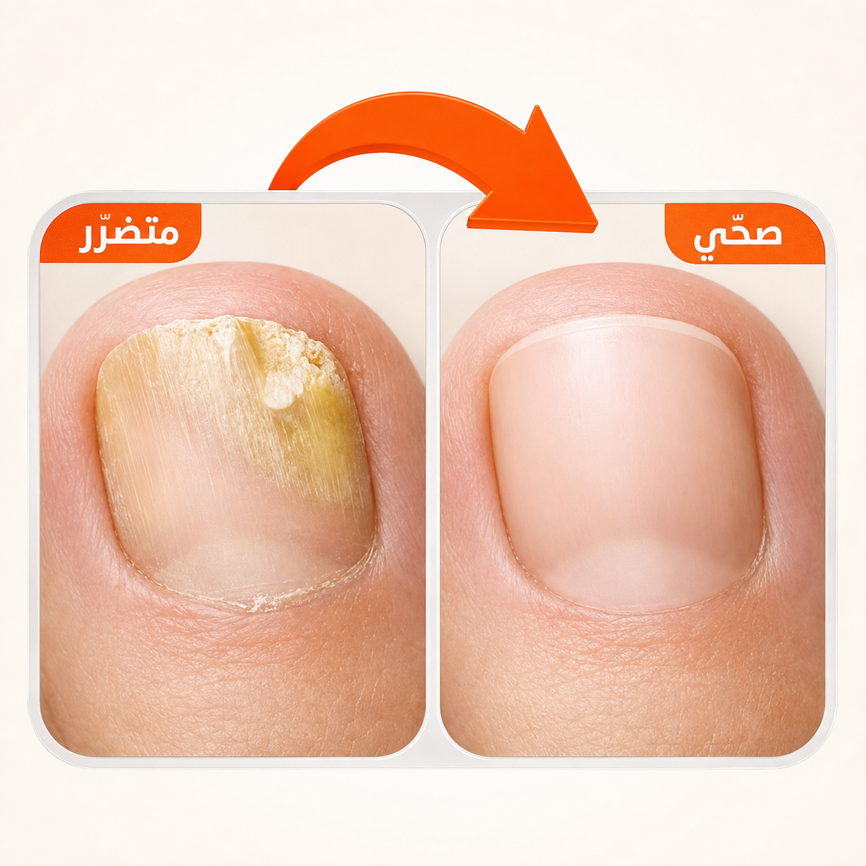 SÉRUM RÉNOVATEUR POUR LES ONGLES Tunirelax™