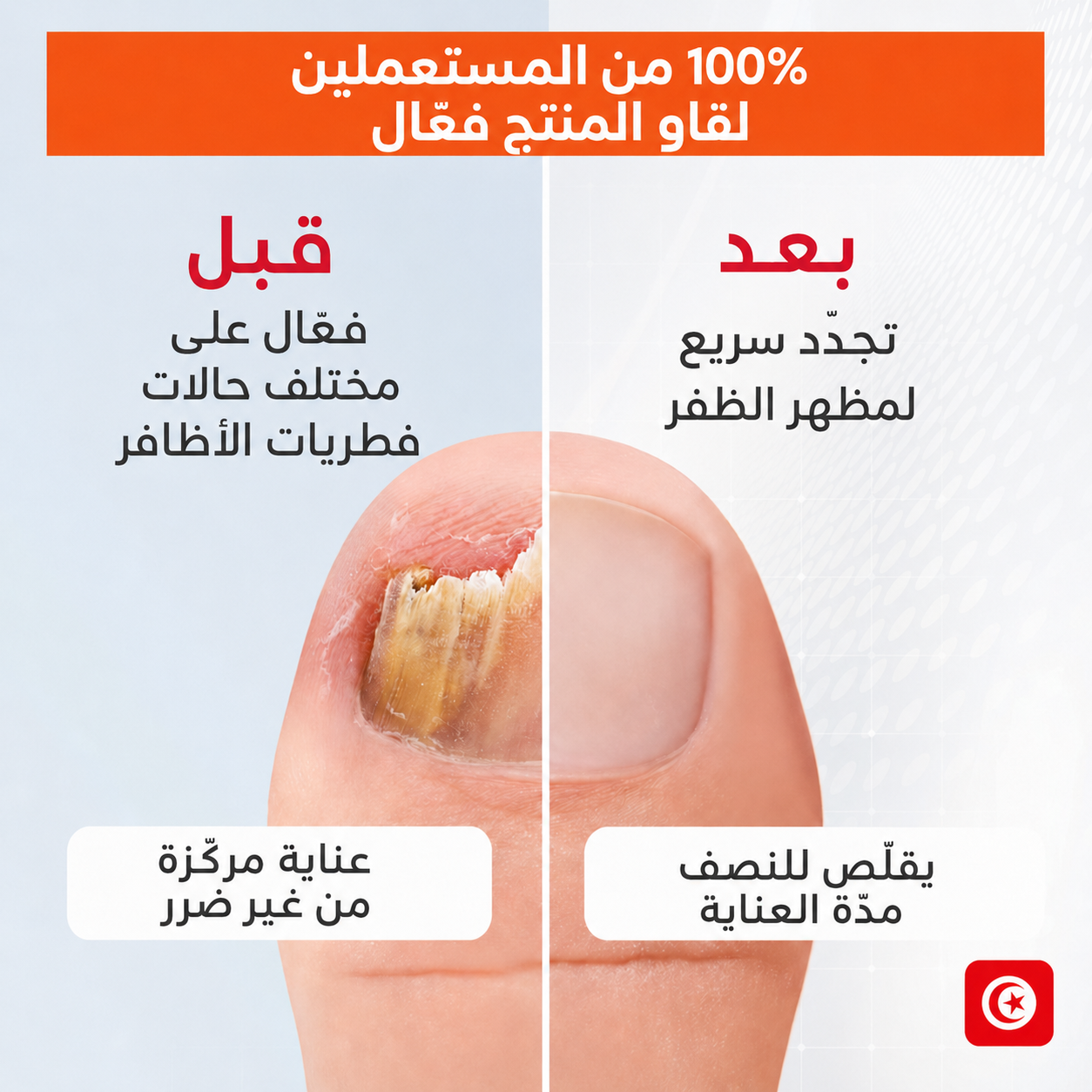 SÉRUM RÉNOVATEUR POUR LES ONGLES Tunirelax™